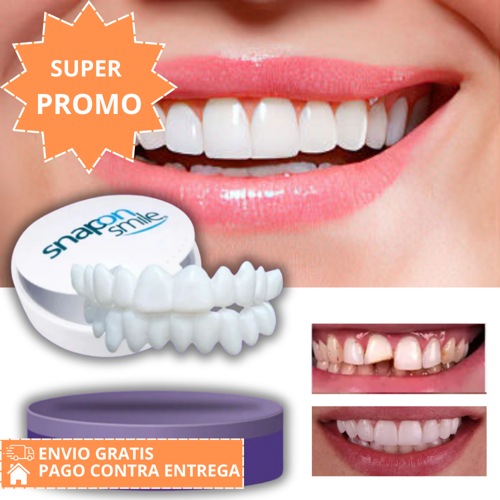 Snap-On Smile®: Carillas Dentales Ajustables - Dientes de Cerámica